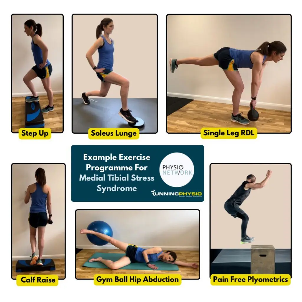 exercises for medial tibial stress syndrome shin splints comprehensive guide 1 - Stoney Stretton Physiotherapy